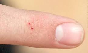 Bat roosting on a wall